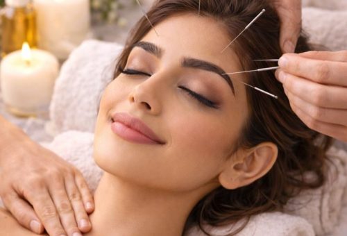 Acupressure & Acupuncture1