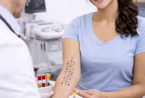 Allergy Testing