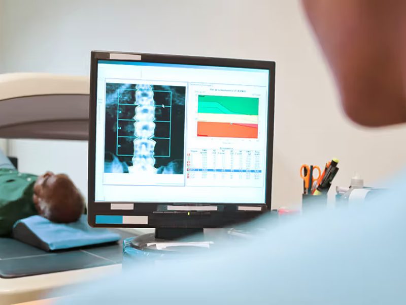 Bone Density Scan Bone Density Scan