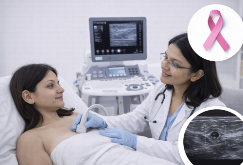 Breast Ultrasound