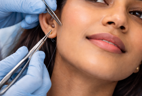 Ear Lobe Repair