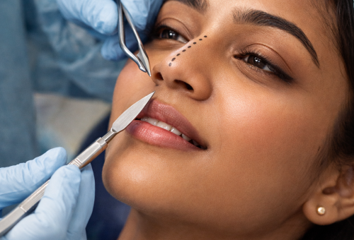 Minor Cosmetic Surgeries