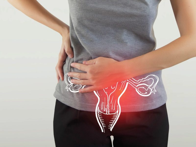 PCOS Management