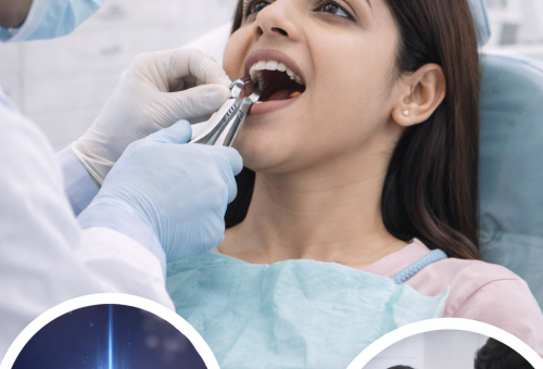 Tooth Extraction