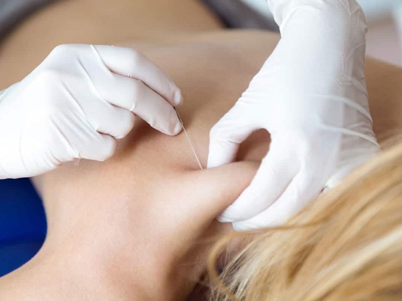 Trigger Point Injections 1