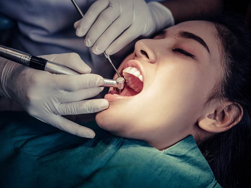 root-canal-treatment